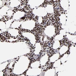 KDM6A Antibody, Novus Biologicals:Antibodies:Primary Antibodies
