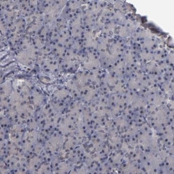 KDM6A Antibody, Novus Biologicals:Antibodies:Primary Antibodies