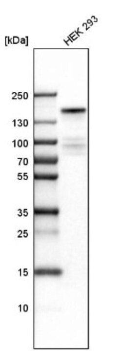 KDM6A Antibody, Novus Biologicals:Antibodies:Primary Antibodies