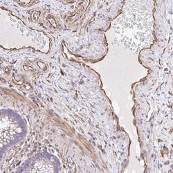 KF1 Antibody, Novus Biologicals:Antibodies:Primary Antibodies