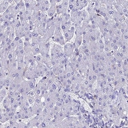 KGF/FGF-7 Antibody, Novus Biologicals 0.1mL; Unlabeled:Antibodies, Polyclonal