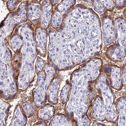 KGF/FGF-7 Antibody, Novus Biologicals 0.1mL; Unlabeled:Antibodies, Polyclonal