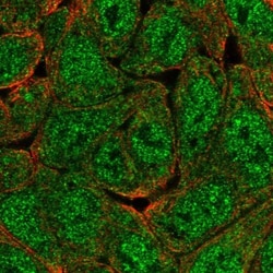 KHNYN Antibody, Novus Biologicals:Antibodies:Primary Antibodies