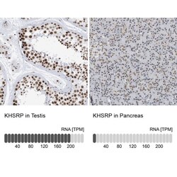 KHSRP Antibody, Novus Biologicals:Antibodies:Primary Antibodies