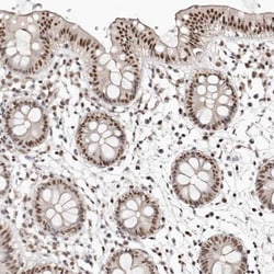 UBLCP1 Antibody, Novus Biologicals:Antibodies:Primary Antibodies