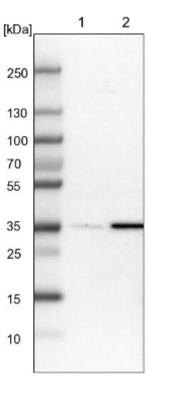SUSD6 Antibody, Novus Biologicals:Antibodies:Primary Antibodies