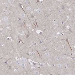 CEP170B Antibody, Novus Biologicals 25 &mu;L, Unlabeled:Antibodies, Polyclonal