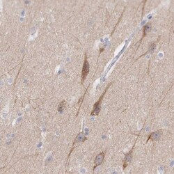 CEP170B Antibody, Novus Biologicals 25 &mu;L | Buy Online | Novus Biologicals | Fisher Scientific