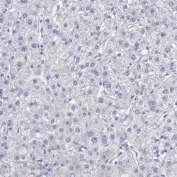 CEP170B Antibody, Novus Biologicals 25 &mu;L | Buy Online | Novus Biologicals | Fisher Scientific