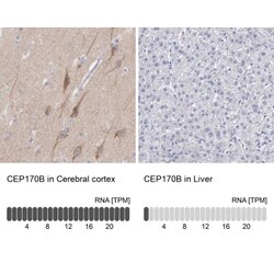 CEP170B Antibody, Novus Biologicals 25 &mu;L | Buy Online | Novus Biologicals | Fisher Scientific