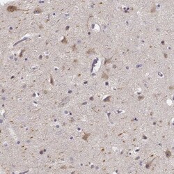 KIAA0319 Antibody, Novus Biologicals 0.1mL; Unlabeled:Antibodies, Polyclonal