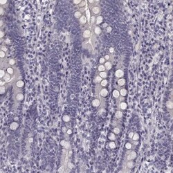 KIAA0319 Antibody, Novus Biologicals 0.1mL; Unlabeled:Antibodies, Polyclonal