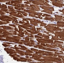 KIAA0408 Antibody, Novus Biologicals 25 &mu;L, Unlabeled:Antibodies, Polyclonal