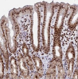 AP5Z1 Antibody, Novus Biologicals 0.1mL; Unlabeled:Antibodies, Polyclonal