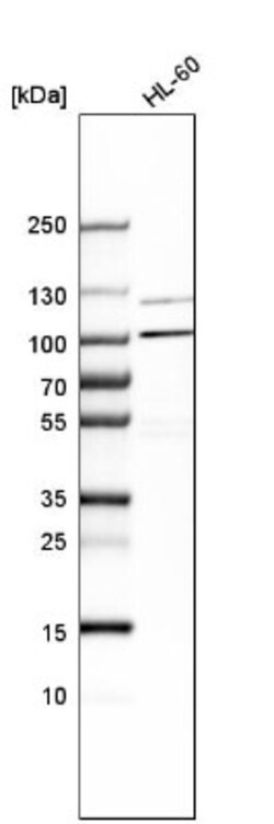 AP5Z1 Antibody, Novus Biologicals 0.1mL; Unlabeled:Antibodies, Polyclonal