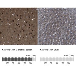 KIAA0513 Antibody, Novus Biologicals 0.1mL; Unlabeled:Antibodies, Polyclonal