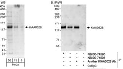 C2CD5 Antibody, Novus Biologicals 0.1mL; Unlabeled:Antibodies, Polyclonal