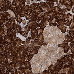 KIAA0556 Antibody, Novus Biologicals:Antibodies:Primary Antibodies