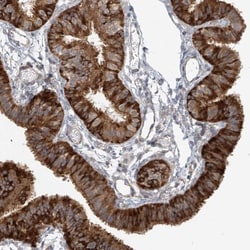 KIAA0556 Antibody, Novus Biologicals:Antibodies:Primary Antibodies