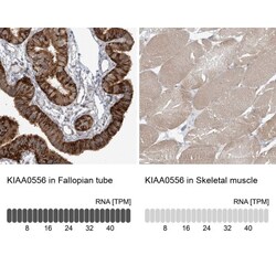 KIAA0556 Antibody, Novus Biologicals:Antibodies:Primary Antibodies