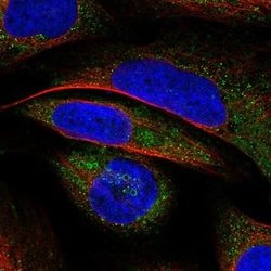 VWA8 Antibody, Novus Biologicals 25 &mu;L, Unlabeled:Antibodies, Polyclonal