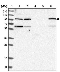 KIAA0753/MNR Antibody, Novus Biologicals 25 &mu;L; Unlabeled:Antibodies,
