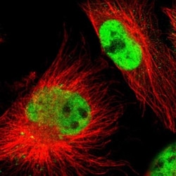 CMTM6 Antibody, Novus Biologicals:Antibodies:Primary Antibodies