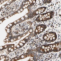 CMTM6 Antibody, Novus Biologicals:Antibodies:Primary Antibodies