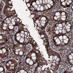 ZSWIM8 Antibody, Novus Biologicals 0.1mL; Unlabeled:Antibodies, Polyclonal