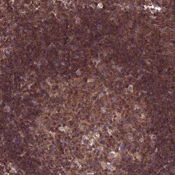 TMEM131L Antibody, Novus Biologicals 0.1mL; Unlabeled:Antibodies, Polyclonal