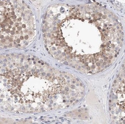 KIAA1109/FSA Antibody, Novus Biologicals 0.1mL; Unlabeled:Antibodies, Polyclonal