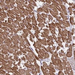 Myogenesis-Regulating Glycosidase Antibody, Novus Biologicals 0.1mL; Unlabeled:Antibodies,