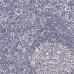 KIAA1210 Antibody, Novus Biologicals 25 &mu;L; Unlabeled:Antibodies, Polyclonal