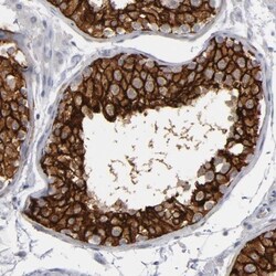 KIAA1210 Antibody, Novus Biologicals 25 &mu;L; Unlabeled:Antibodies, Polyclonal