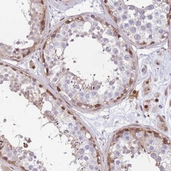 KIAA1211 Antibody, Novus Biologicals 25 &mu;L, Unlabeled:Antibodies, Polyclonal