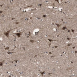 KANSL1 Antibody, Novus Biologicals:Anticorps:Anticorps primaires