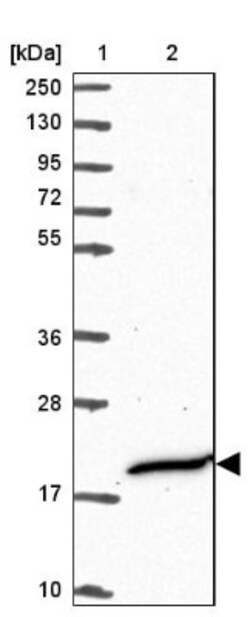 CFAP97 Antibody, Novus Biologicals 25 &mu;L; Unlabeled:Antibodies, Polyclonal