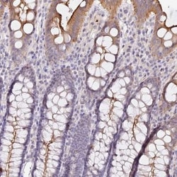 CAMSAP3 Antibody, Novus Biologicals:Antibodies:Primary Antibodies
