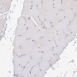 CAMSAP3 Antibody, Novus Biologicals:Antibodies:Primary Antibodies