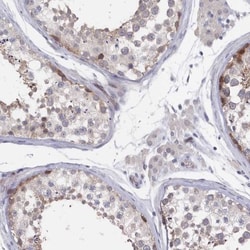 SPAG9 Antibody, Novus Biologicals:Antibodies:Primary Antibodies