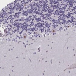 IQCN Antibody, Novus Biologicals 25 &mu;L; Unlabeled:Antibodies, Polyclonal