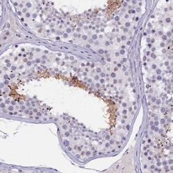 IQCN Antibody, Novus Biologicals 25 &mu;L; Unlabeled:Antibodies, Polyclonal