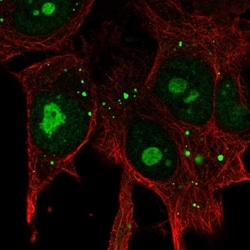 KIAA1755 Antibody, Novus Biologicals 25 &mu;L, Unlabeled:Antibodies, Polyclonal
