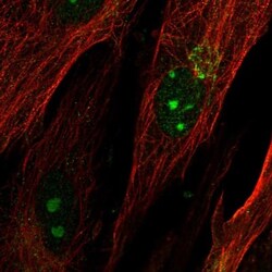 KIAA1755 Antibody, Novus Biologicals 25 &mu;L, Unlabeled:Antibodies, Polyclonal