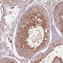 KIAA1755 Antibody, Novus Biologicals 25 &mu;L, Unlabeled:Antibodies, Polyclonal