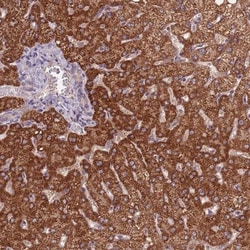 KIAA1841 Antibody, Novus Biologicals:Antibodies:Primary Antibodies