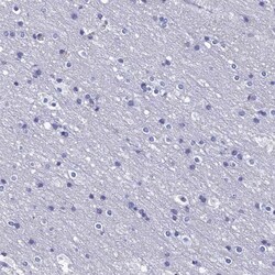 PPP1R18 Antibody, Novus Biologicals:Antibodies:Primary Antibodies