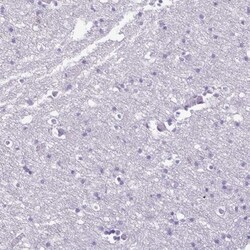 PPP1R18 Antibody, Novus Biologicals 0.1mL; Unlabeled:Antibodies, Polyclonal
