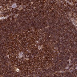 PPP1R18 Antibody, Novus Biologicals 0.1mL; Unlabeled:Antibodies, Polyclonal