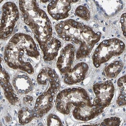 KIAA1958 Antibody, Novus Biologicals:Antibodies:Primary Antibodies